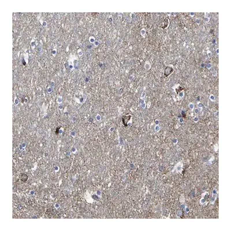 Merck Anti-HK1 antibody produced in rabbit