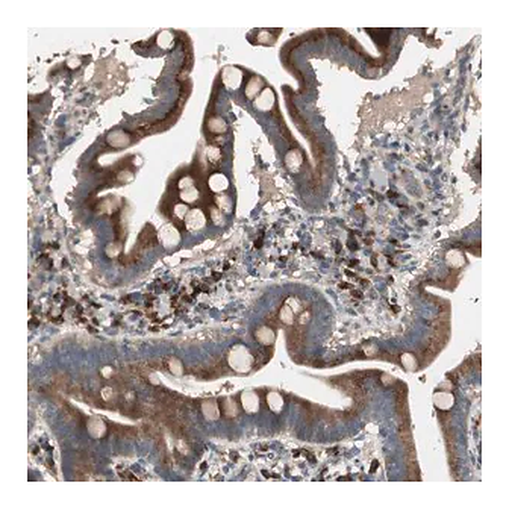 Merck Anti-RARRES1 antibody produced in rabbit