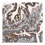 Merck Anti-RARRES1 antibody produced in rabbit