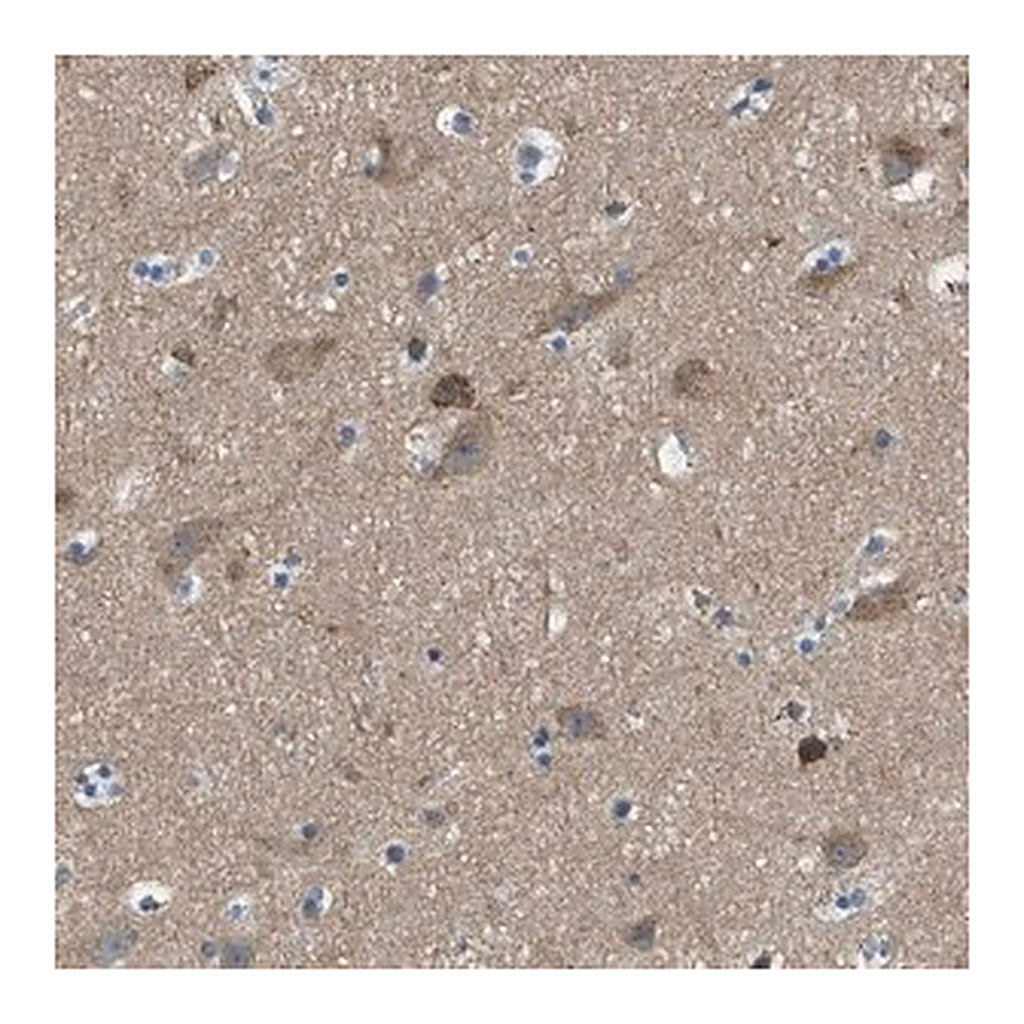Merck Anti-PIP5K1C antibody produced in rabbit