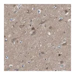 Merck Anti-PIP5K1C antibody produced in rabbit