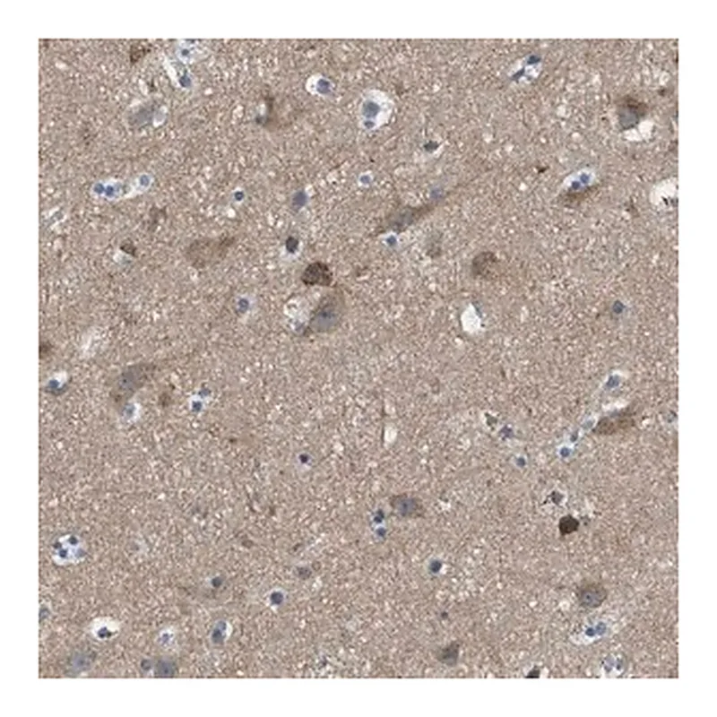 Merck Anti-PIP5K1C antibody produced in rabbit