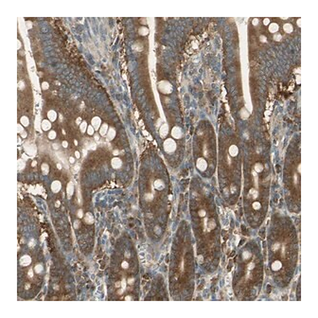 Merck Anti-RARS antibody produced in rabbit