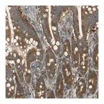 Merck Anti-RARS antibody produced in rabbit