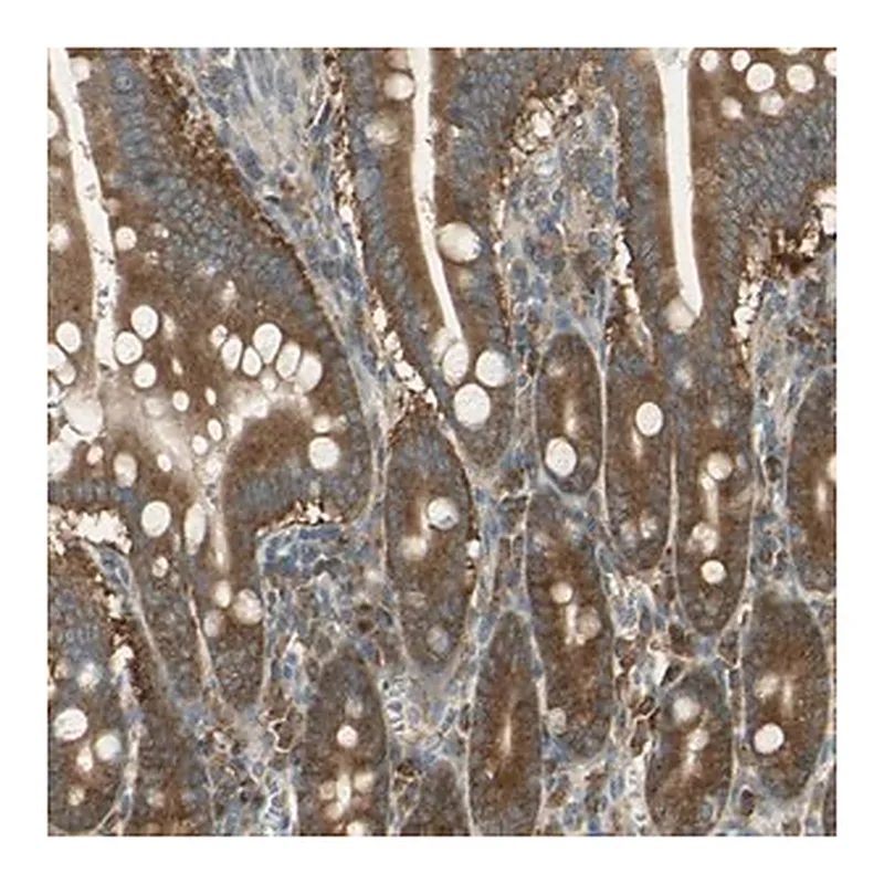 Merck Anti-RARS antibody produced in rabbit