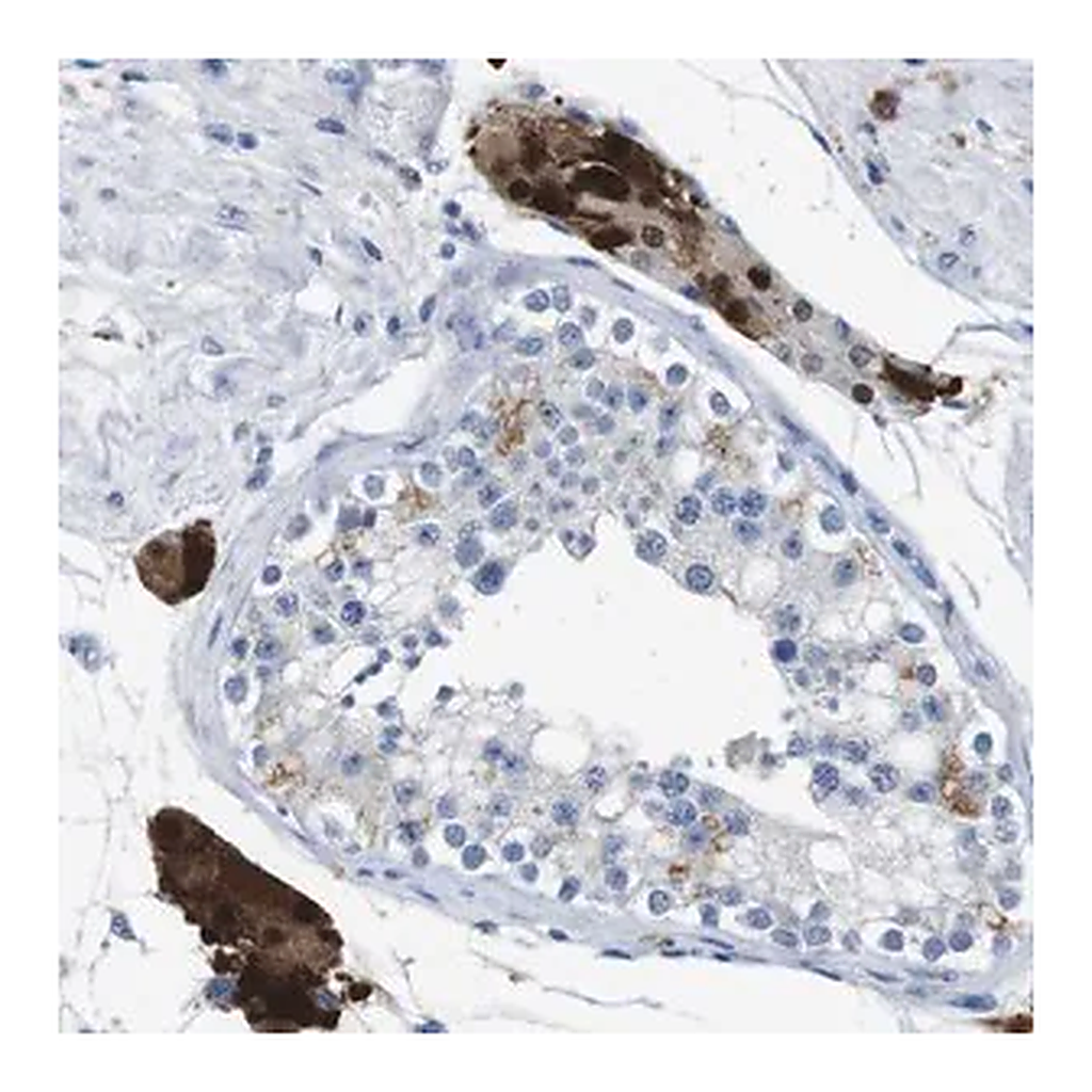 Merck Anti-SLC2A8 antibody produced in rabbit