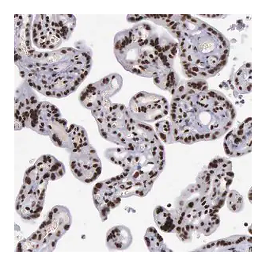 Merck Anti-YY1 antibody produced in rabbit