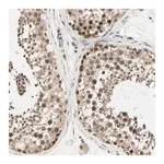 Merck Anti-MCPH1 antibody produced in rabbit