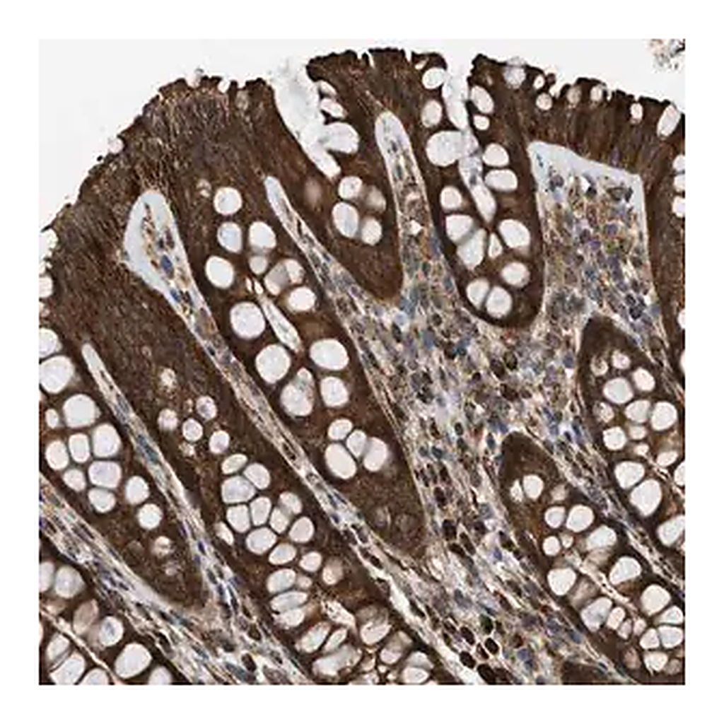 Merck Anti-SESN2 antibody produced in rabbit