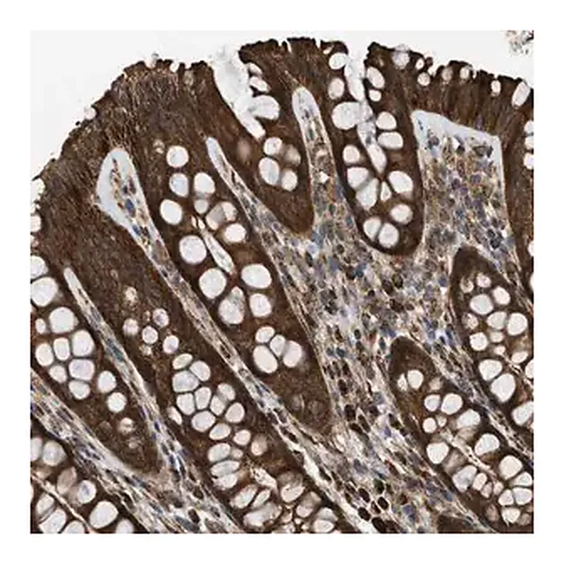 Merck Anti-SESN2 antibody produced in rabbit