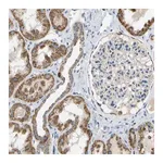 Merck Anti-HLCS antibody produced in rabbit