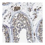 Merck Anti-C6orf89 antibody produced in rabbit