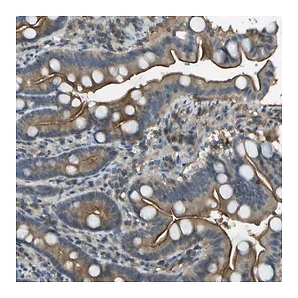 Merck Anti-LRRC66 antibody produced in rabbit