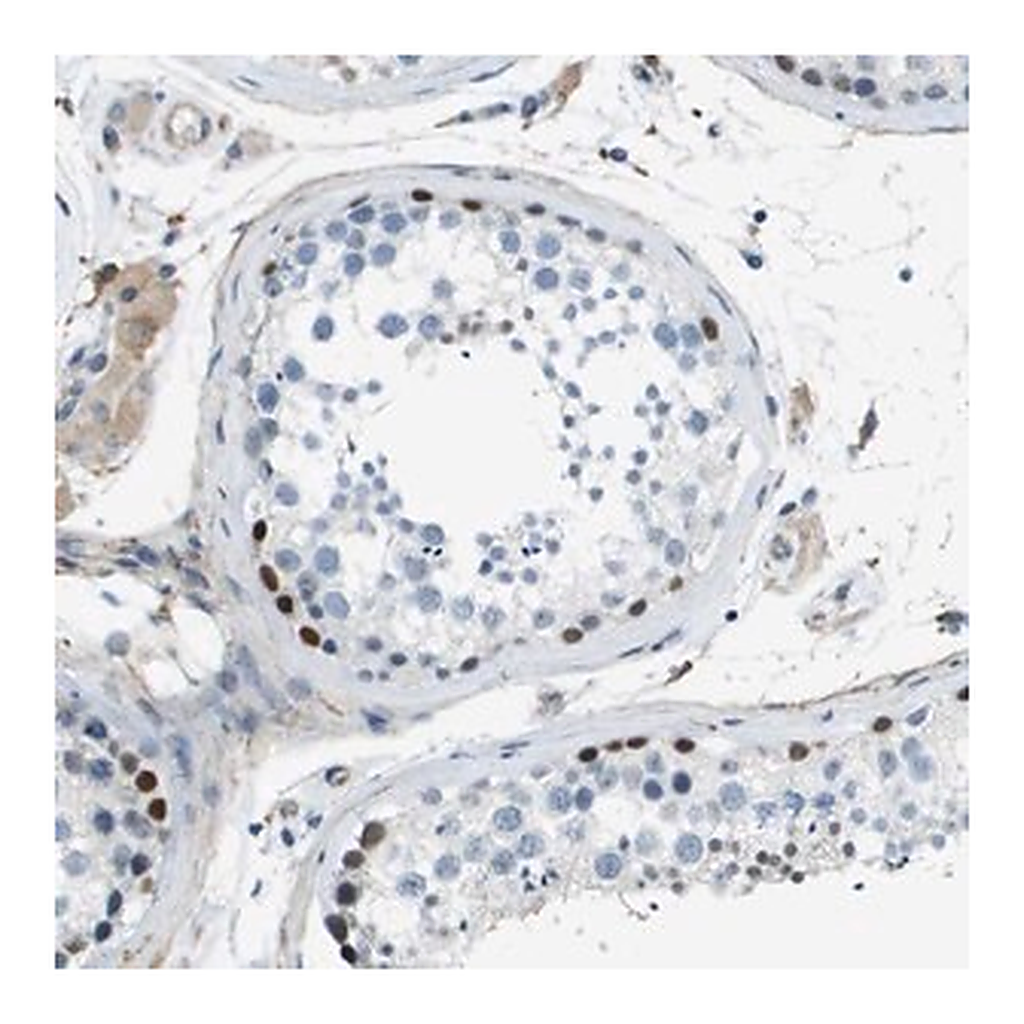 Merck Anti-ZBTB43 antibody produced in rabbit