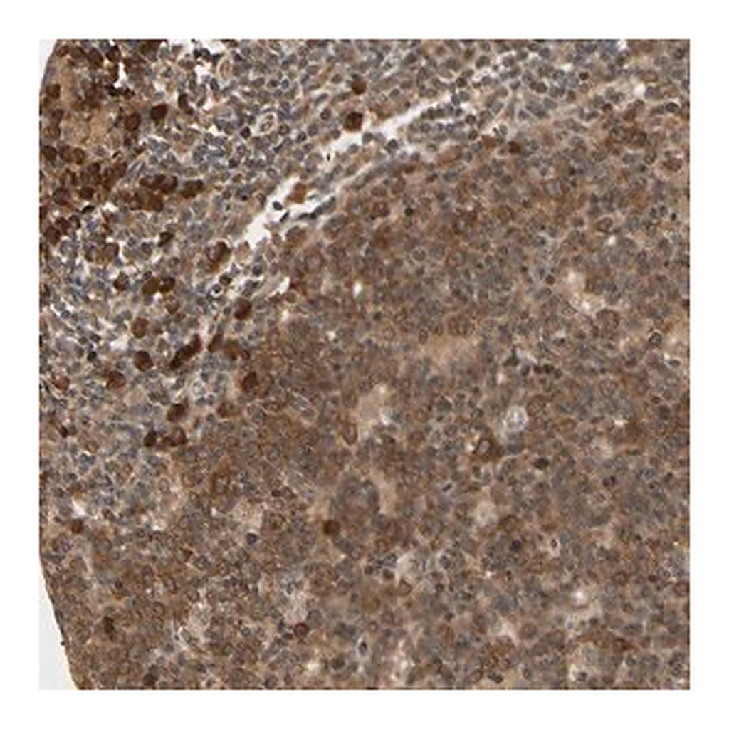 Merck Anti-CYTIP antibody produced in rabbit