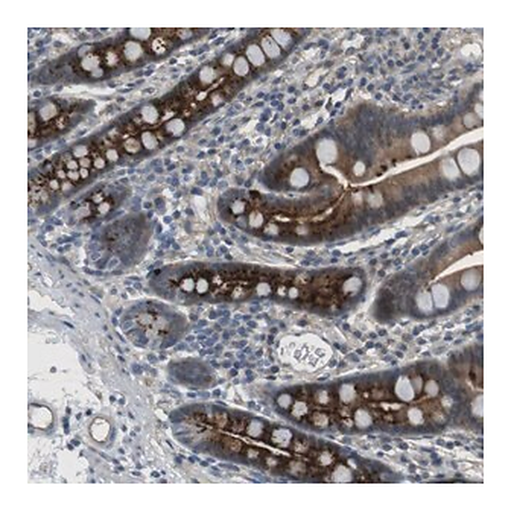 Merck Anti-ABHD15 antibody produced in rabbit