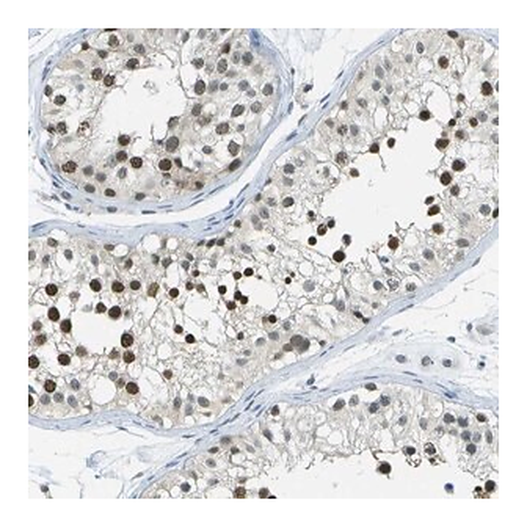 Merck Anti-NEK11 antibody produced in rabbit