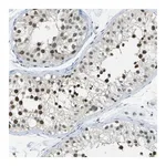 Merck Anti-NEK11 antibody produced in rabbit