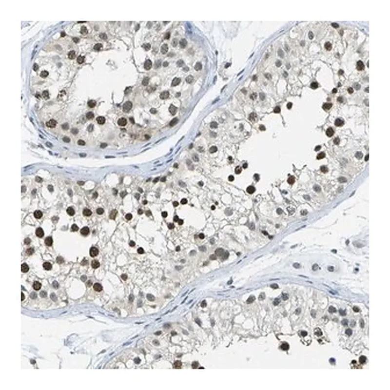 Merck Anti-NEK11 antibody produced in rabbit