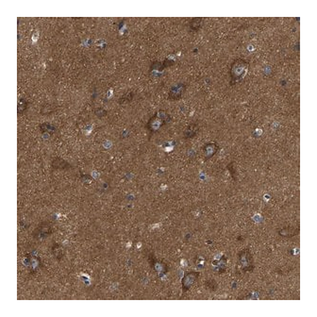 Merck Anti-ABCA10 antibody produced in rabbit