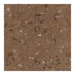 Merck Anti-ABCA10 antibody produced in rabbit