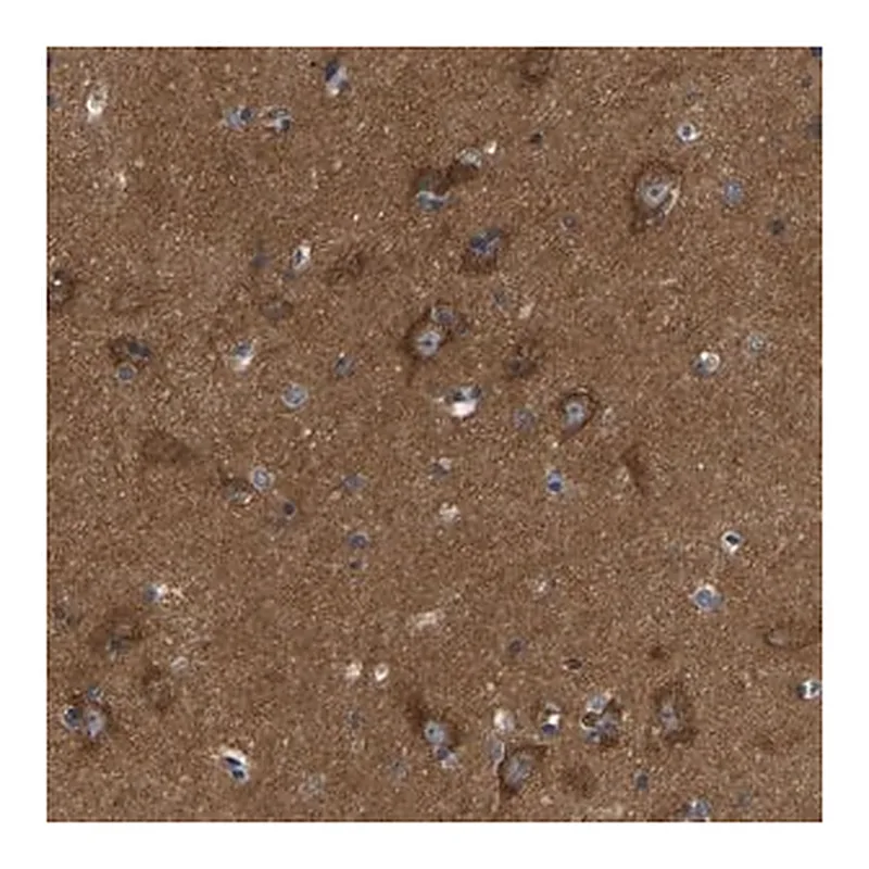 Merck Anti-ABCA10 antibody produced in rabbit