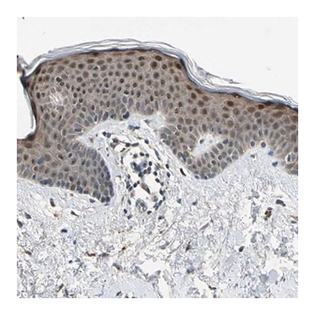 Merck Anti-RPS6KB2 antibody produced in rabbit