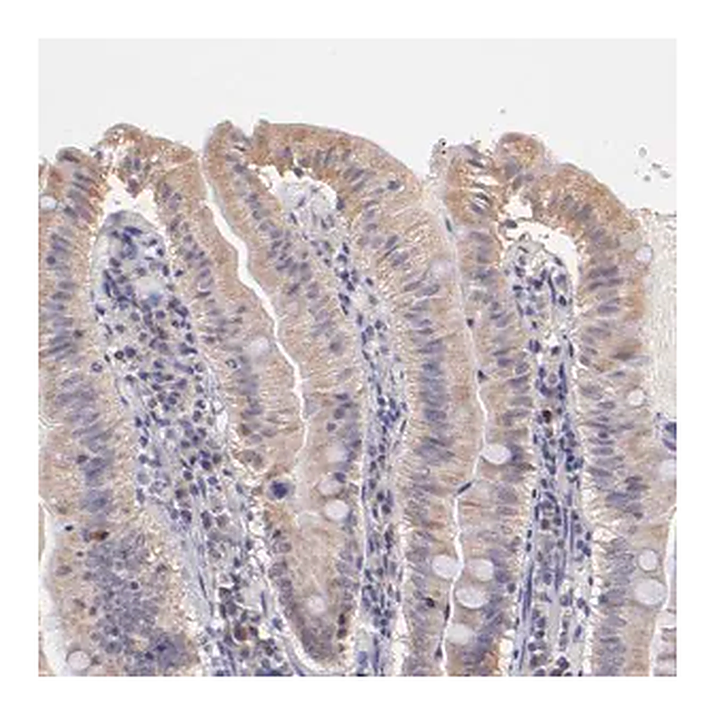 Merck Anti-RNASEL antibody produced in rabbit