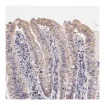 Merck Anti-RNASEL antibody produced in rabbit