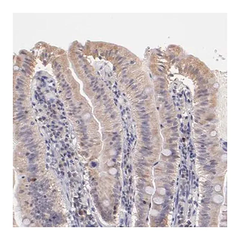 Merck Anti-RNASEL antibody produced in rabbit