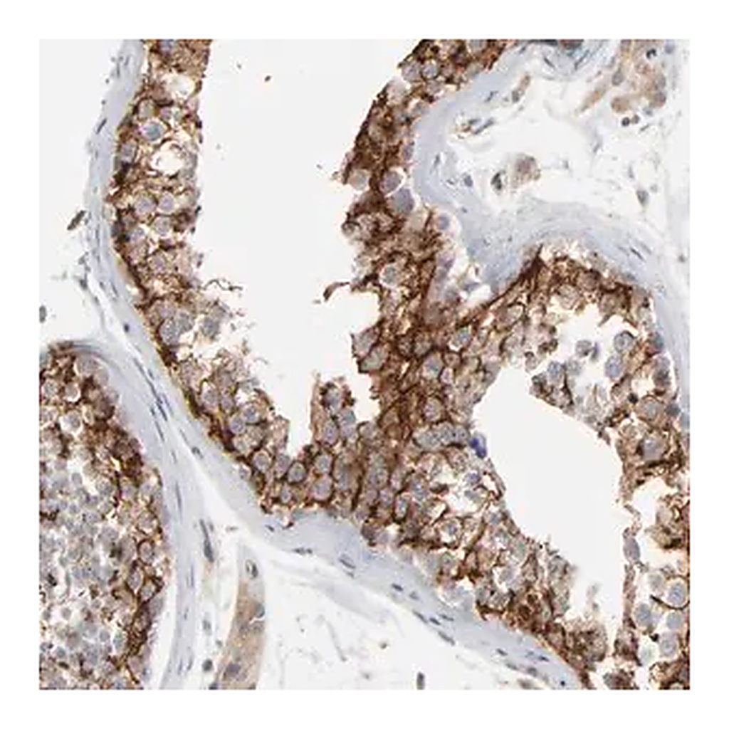Merck Anti-ITPR3 antibody produced in rabbit