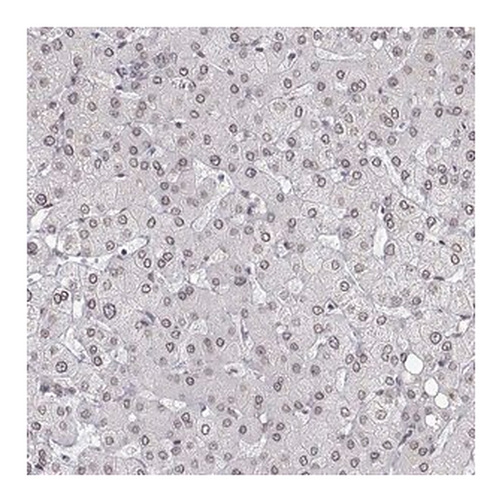 Merck Anti-ZNF532 antibody produced in rabbit