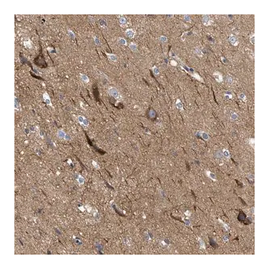 Merck Anti-THRA antibody produced in rabbit