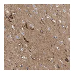 Merck Anti-THRA antibody produced in rabbit