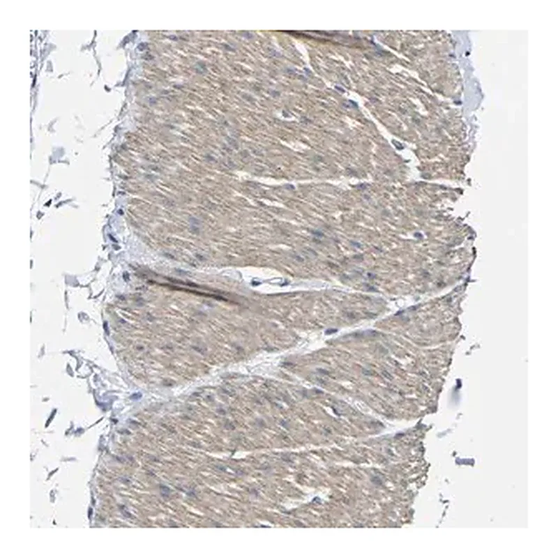 Merck Anti-TNFAIP1 antibody produced in rabbit