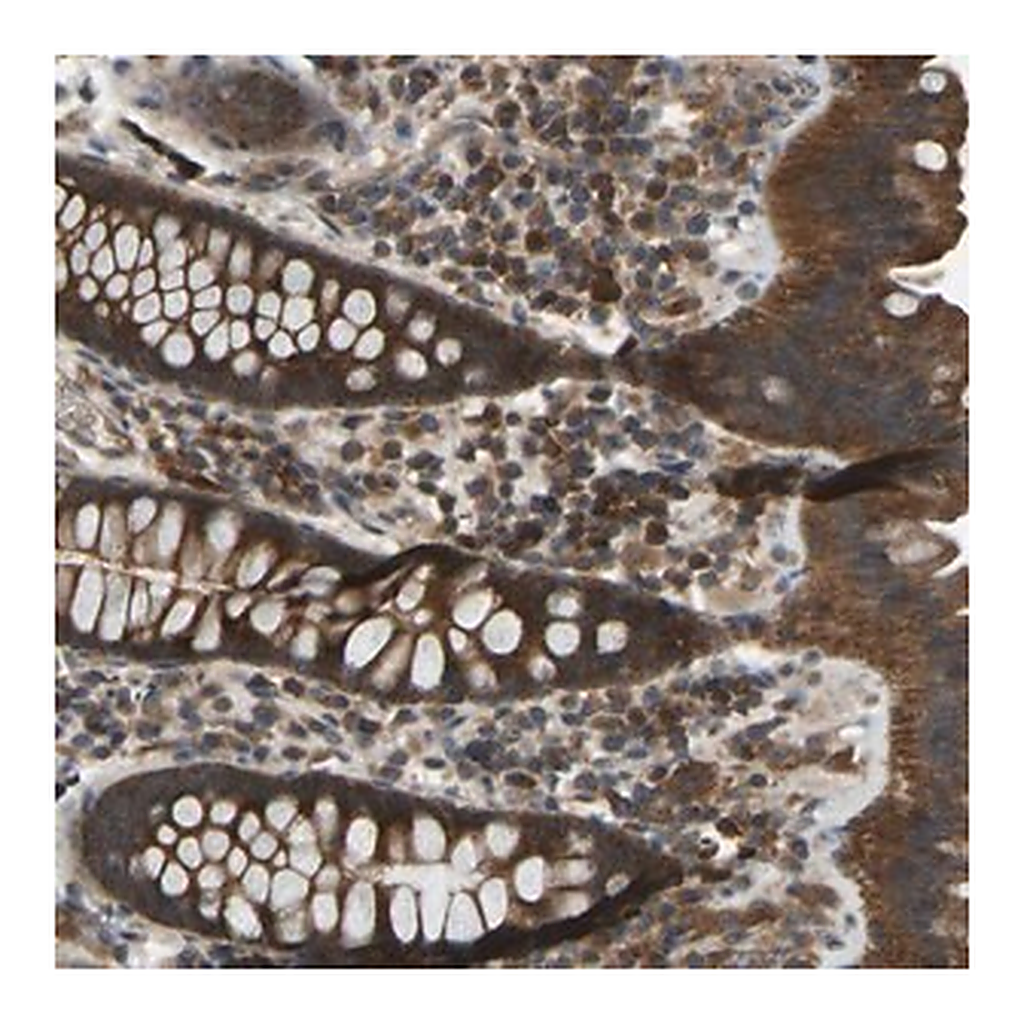 Merck Anti-ZNF71 antibody produced in rabbit