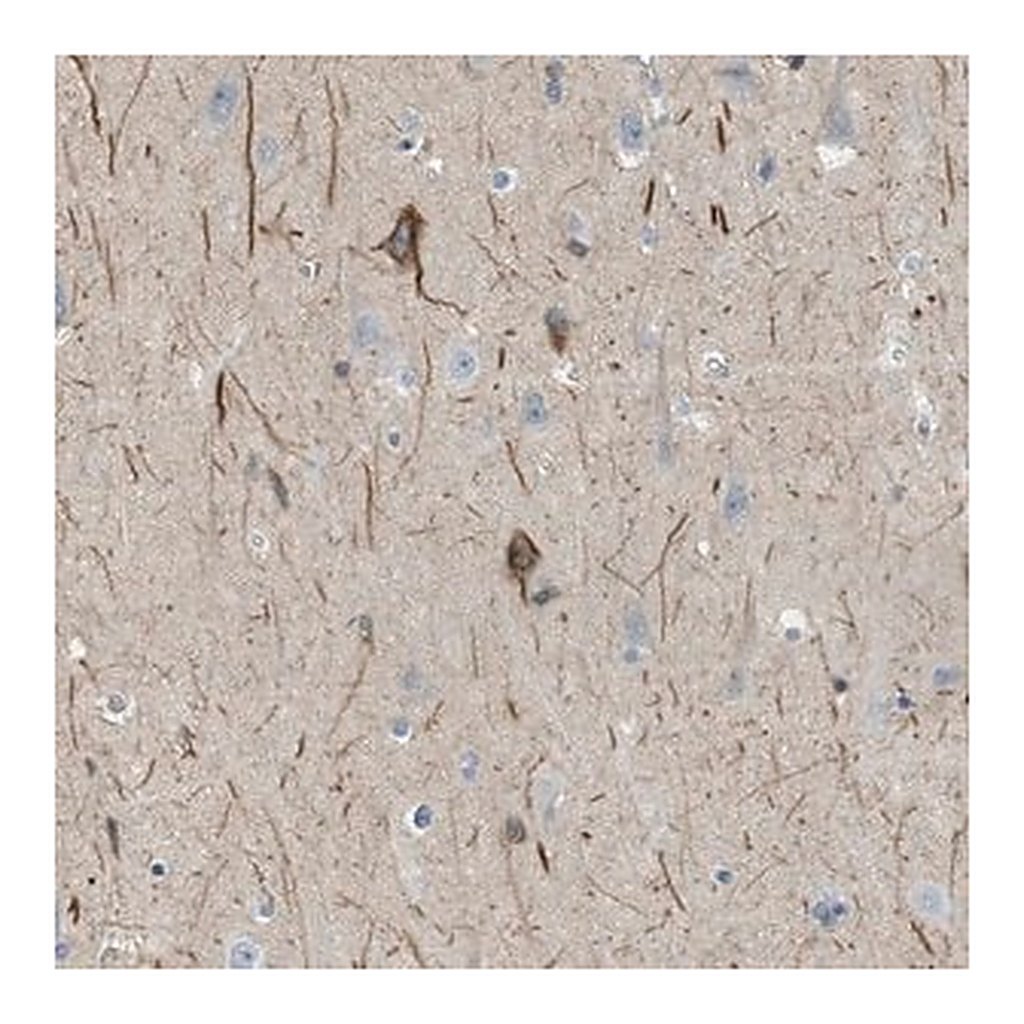 Merck Anti-GRIK2 antibody produced in rabbit