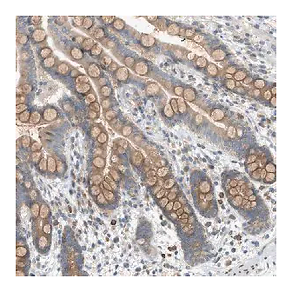Merck Anti-DYRK1A antibody produced in rabbit