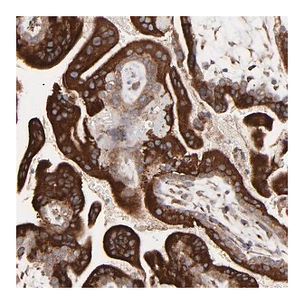 Merck Anti-ELP2 antibody produced in rabbit