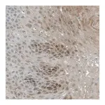Merck Anti-SERPINB2 antibody produced in rabbit