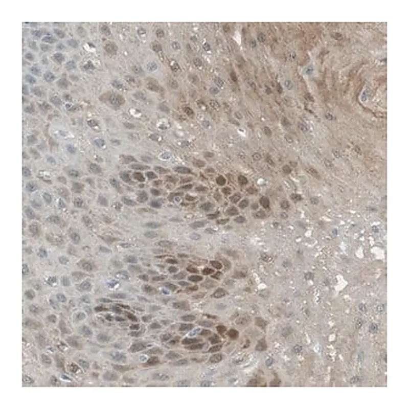 Merck Anti-SERPINB2 antibody produced in rabbit