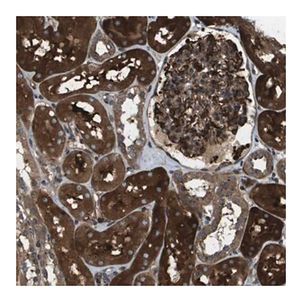 Merck Anti-PHF11 antibody produced in rabbit
