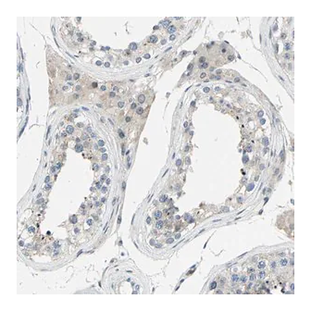 Merck Anti-ZNF184 antibody produced in rabbit