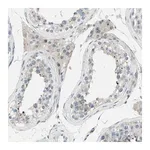 Merck Anti-ZNF184 antibody produced in rabbit