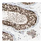 Merck Anti-HSPA4 antibody produced in rabbit