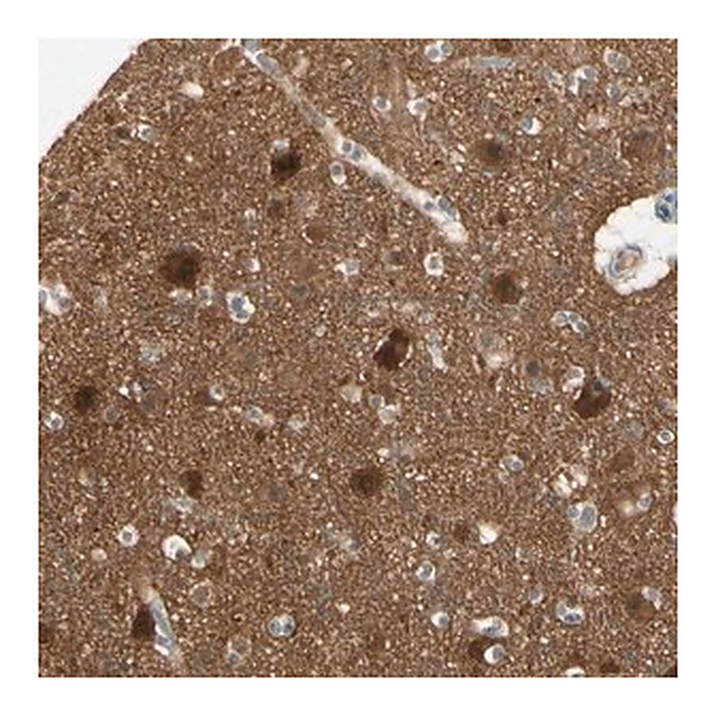Merck Anti-PPP3CB antibody produced in rabbit