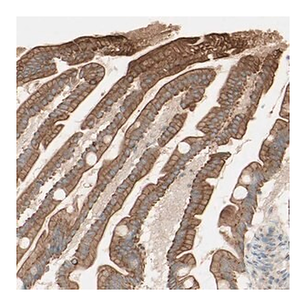 Merck Anti-MTM1 antibody produced in rabbit