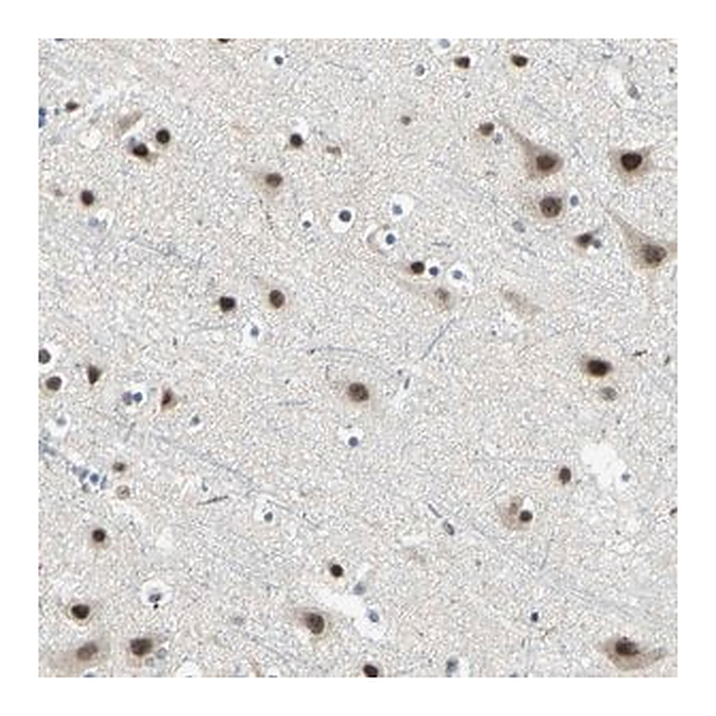 Merck Anti-MTA1 antibody produced in rabbit