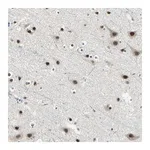 Merck Anti-MTA1 antibody produced in rabbit