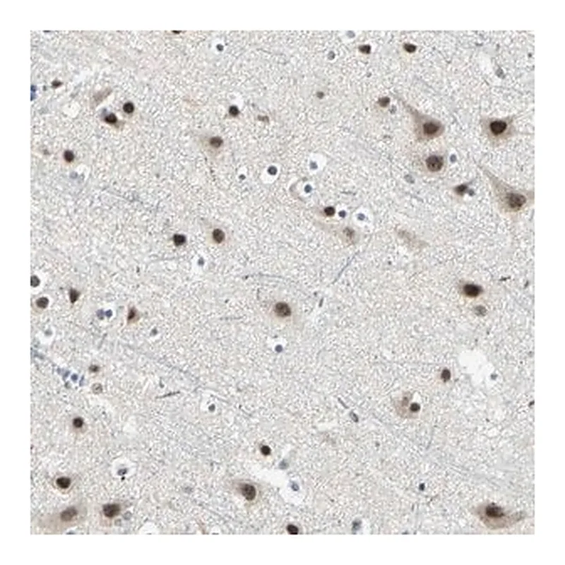 Merck Anti-MTA1 antibody produced in rabbit